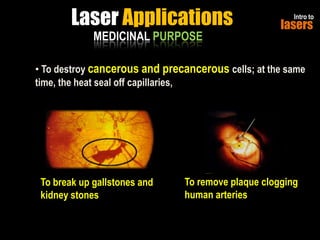 Laser Applications
MEDICINAL PURPOSE

Intro to

lasers

• To destroy cancerous and precancerous cells; at the same
time, the heat seal off capillaries,

To break up gallstones and
kidney stones

To remove plaque clogging
human arteries

 