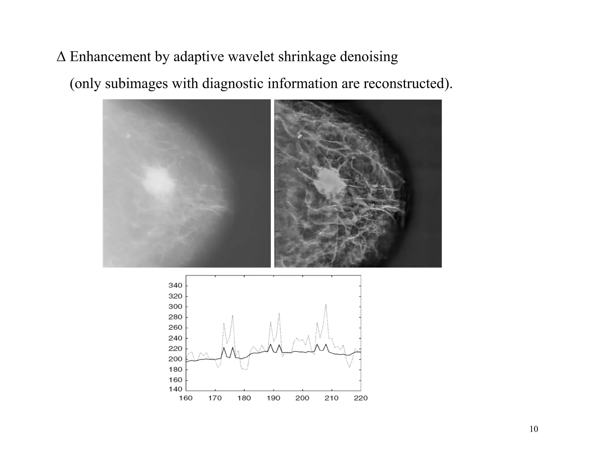 10
Δ Enhancement by adaptive wavelet shrinkage denoising
(only subimages with diagnostic information are reconstructed).
 