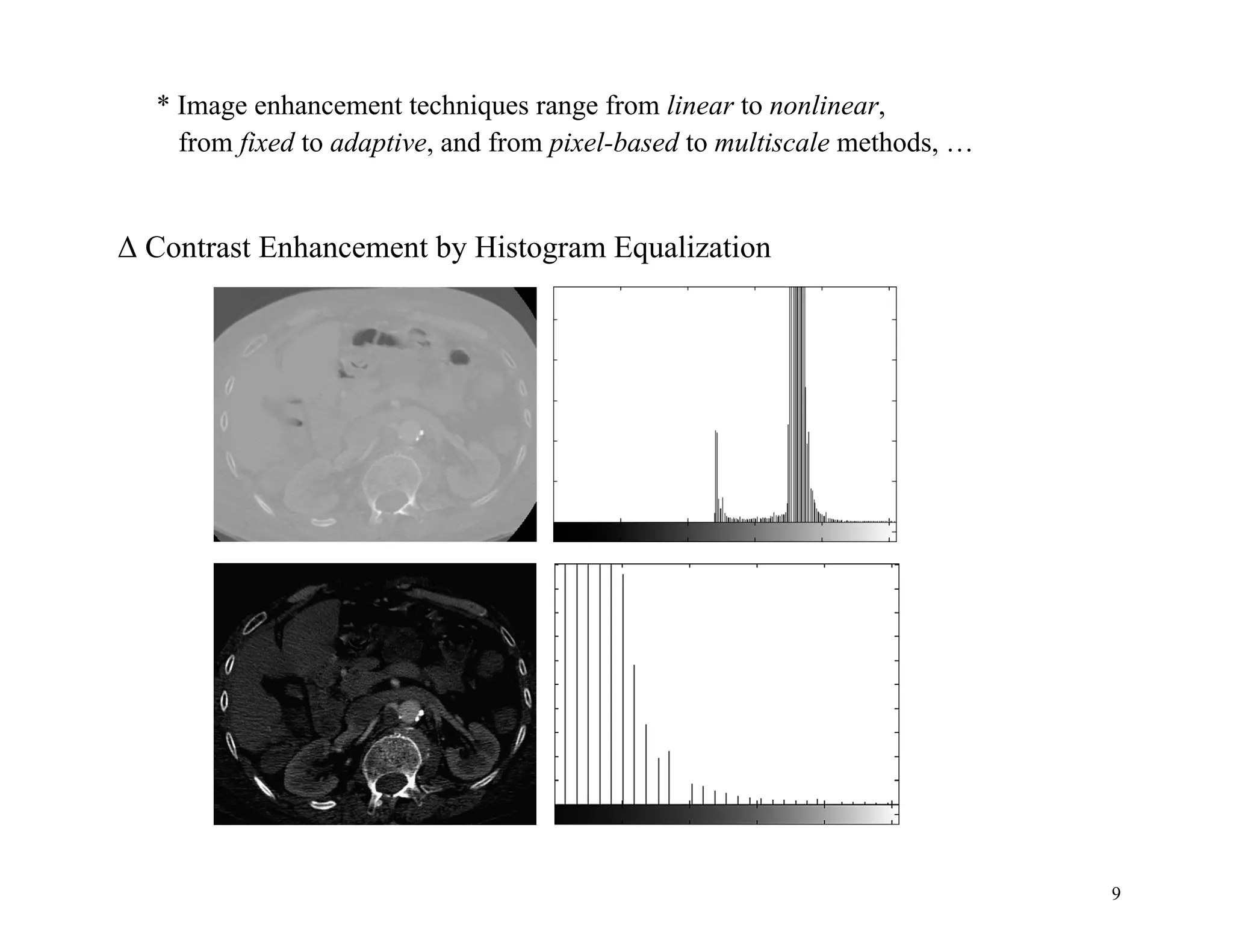 9
* Image enhancement techniques range from linear to nonlinear,
from fixed to adaptive, and from pixel-based to multiscale methods, …
Δ Contrast Enhancement by Histogram Equalization
 
