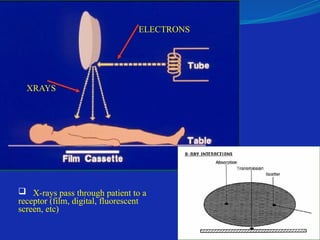  X-rays pass through patient to a
receptor (film, digital, fluorescent
screen, etc)
ELECTRONS
XRAYS
 