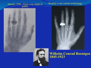 January 1896 - First x-ray made in
public
Routine x-ray current technology
Wilhelm Conrad Roentgen
1845-1923
 