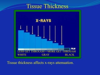 Tissue thickness affects x-rays attenuation.
WHITE GRAY BLACK
Tissue Thickness
LESS GET THROUGH>>MORE GET THROUGH
 