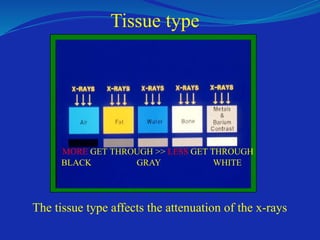 The tissue type affects the attenuation of the x-rays
BLACK GRAY WHITE
Tissue type
MORE GET THROUGH >> LESS GET THROUGH
 