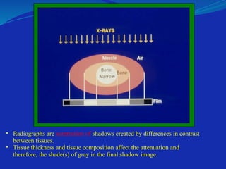 • Radiographs are summation of shadows created by differences in contrast
between tissues.
• Tissue thickness and tissue composition affect the attenuation and
therefore, the shade(s) of gray in the final shadow image.
 