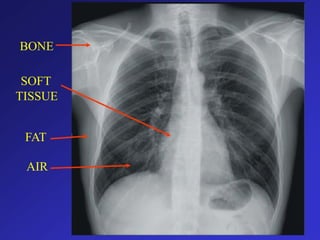 TISSUE
BONE
SOFT
FAT
AIR
 