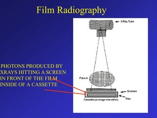 Film Radiography
PHOTONS PRODUCED BY
XRAYS HITTING A SCREEN
IN FRONT OF THE FILM
INSIDE OF A CASSETTE
 
