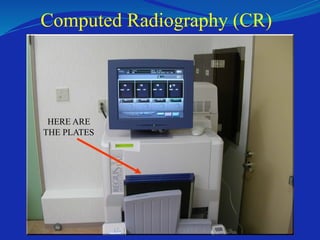 Computed Radiography (CR)
HERE ARE
THE PLATES
 