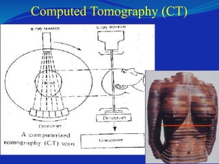 Computed Tomography (CT)
 
