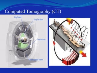Computed Tomography (CT)
 