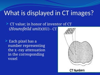 What is displayed in CT images?
 CT value; in honor of inventor of CT
(Hounsfeild unit)(HU) - CT numbers.
 Each pixel has a
number representing
the x -ray attenuation
in the corresponding
voxel
 