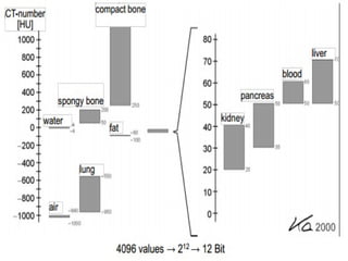 Hounsfield Scale
 