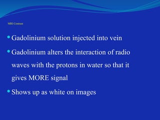 MRI Contrast
 Gadolinium solution injected into vein
 Gadolinium alters the interaction of radio
waves with the protons in water so that it
gives MORE signal
 Shows up as white on images
 