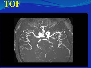 TOF
 