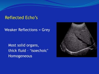 Reflected Echo’s
Weaker Reflections = Grey
Most solid organs,
thick fluid – ‘isoechoic’
Homogeneous
 