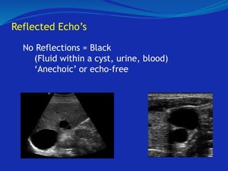 Reflected Echo’s
No Reflections = Black
(Fluid within a cyst, urine, blood)
‘Anechoic’ or echo-free
 