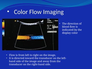 • Color Flow Imaging
• The direction of
blood flow is
indicated by the
display color
• Flow is from left to right on the image,
• It is directed toward the transducer on the left-
hand side of the image and away from the
transducer on the right-hand side.
 