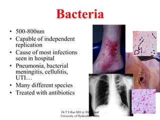 Bacteria
• 500-800nm
• Capable of independent
replication
• Cause of most infections
seen in hospital
• Pneumonia, bacterial
meningitis, cellulitis,
UTI…
• Many different species
• Treated with antibiotics
Dr.T.V.Rao MD @ IFCAI and
University of Hyderabad India
48
 