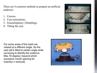 Dimpling Method INTRODUCTION TO MOUTH PREPARATION FOR RPD AND FPD.pptx