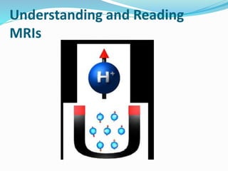 Understanding and Reading
MRIs
 