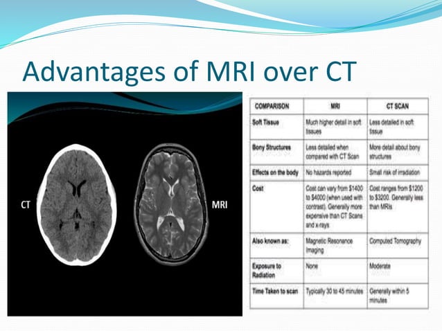 Introduction to mri | PPTX