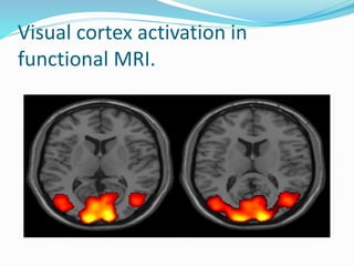 Visual cortex activation in
functional MRI.
 