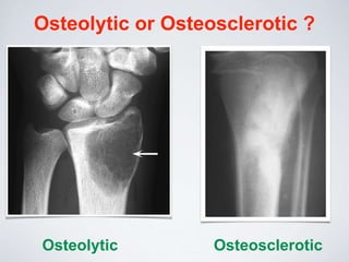 Introduction to muscloskletal tumors | PPTX