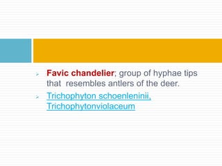  Favic chandelier; group of hyphae tips
that resembles antlers of the deer.
 Trichophyton schoenleninii,
Trichophytonviolaceum
 