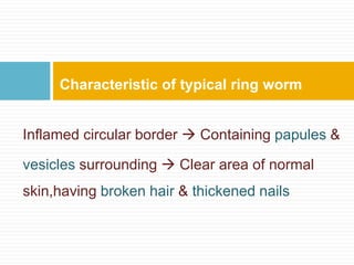 Inflamed circular border  Containing papules &
vesicles surrounding  Clear area of normal
skin,having broken hair & thickened nails
Characteristic of typical ring worm
 