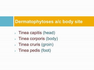  Tinea capitis (head)
 Tinea corporis (body)
 Tinea cruris (groin)
 Tinea pedis (foot)
Dermatophytoses a/c body site
 