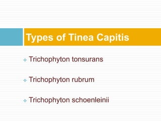  Trichophyton tonsurans
 Trichophyton rubrum
 Trichophyton schoenleinii
Types of Tinea Capitis
 