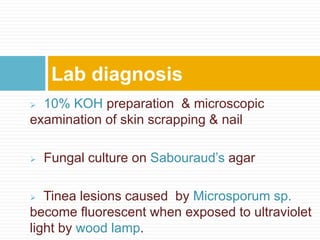  10% KOH preparation & microscopic
examination of skin scrapping & nail
 Fungal culture on Sabouraud’s agar
 Tinea lesions caused by Microsporum sp.
become fluorescent when exposed to ultraviolet
light by wood lamp.
Lab diagnosis
 