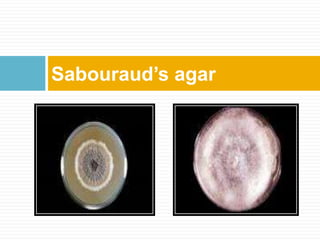 Sabouraud’s agar
 