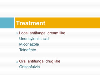  Local antifungal cream like
Undecylenic acid
Miconazole
Tolnaftate
 Oral antifungal drug like
Griseofulvin
Treatment
 