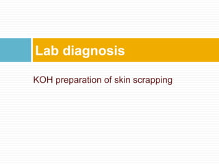 KOH preparation of skin scrapping
Lab diagnosis
 