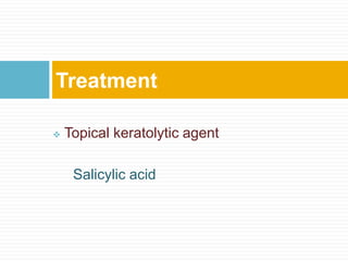 Topical keratolytic agent
Salicylic acid
Treatment
 