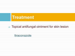  Topical antifungal ointment for skin lesion
Itraconazole
Treatment
 