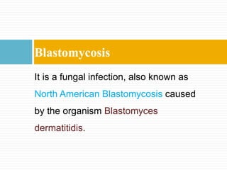 Blastomycosis
It is a fungal infection, also known as
North American Blastomycosis caused
by the organism Blastomyces
dermatitidis.
 