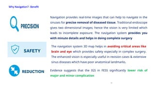 Why Navigation?- Benefit
12
Navigation provides real-time images that can help to navigate in the
sinuses for precise removal of diseased tissue. Traditional endoscope
gives two dimensional images; hence the vision is very limited which
leads to incomplete exposure. The navigation system provides you
with minute details and helps in doing complete surgery
The navigation system 3D map helps in avoiding critical areas like
brain and eye which provides safety especially in complex surgery.
The enhanced vision is especially useful in revision cases & extensive
sinus diseases which have poor anatomical landmarks.
Evidence suggests that the IGS in FESS significantly lower risk of
major and minor complication
 