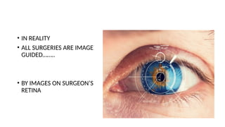 • IN REALITY
• ALL SURGERIES ARE IMAGE
GUIDED……..
• BY IMAGES ON SURGEON’S
RETINA
 