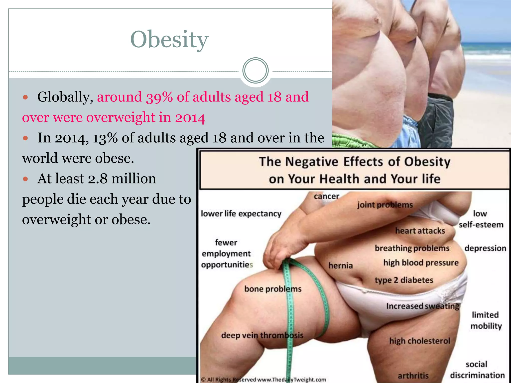 Obesity
 Globally, around 39% of adults aged 18 and
over were overweight in 2014
 In 2014, 13% of adults aged 18 and over in the
world were obese.
 At least 2.8 million
people die each year due to
overweight or obese.
 