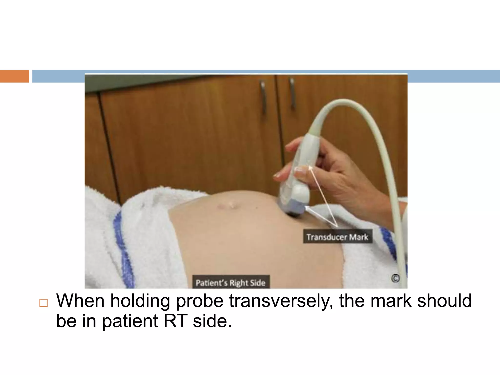  When holding probe transversely, the mark should
be in patient RT side.
 