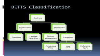 introduction to Ocular trauma.pptx