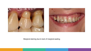 Introduction to operative dentistry and Patient assessment.pptx