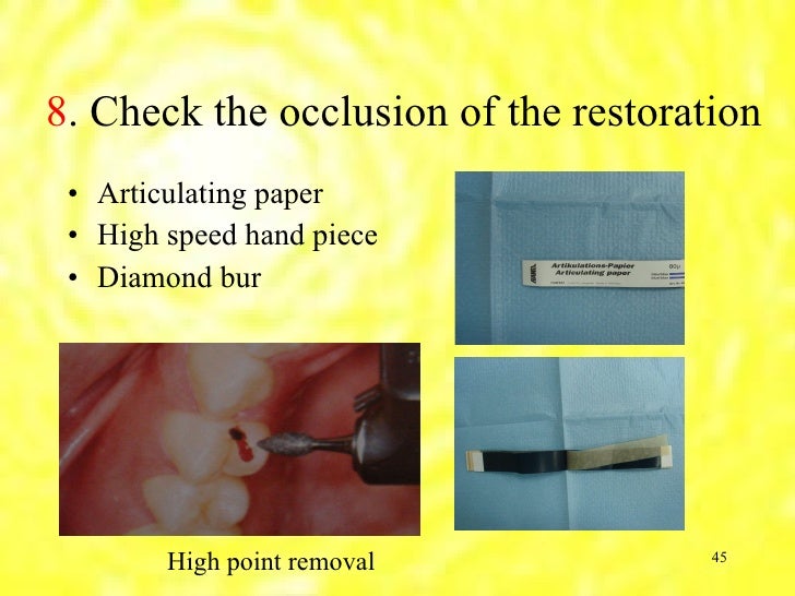 Introduction to operative dentistry,part2