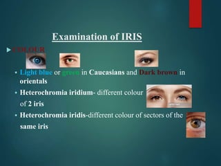 Introduction to ophthalmolgy for medical students | PPTX