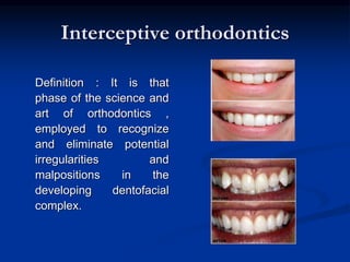 Interceptive Definition Introduction to orthodontics | PPT