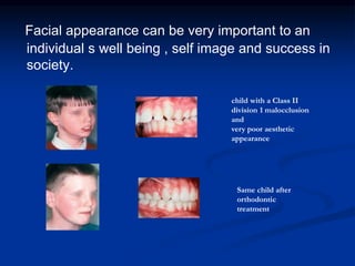 Introduction to orthodontics