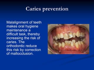 Introduction to orthodontics