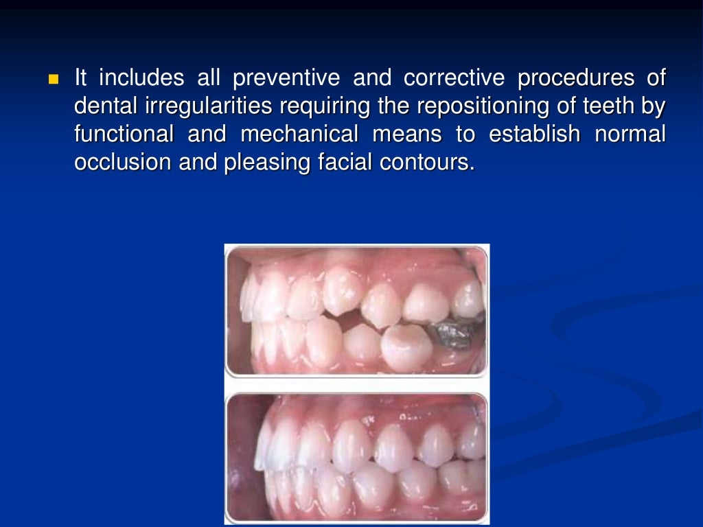 Introduction to orthodontics
