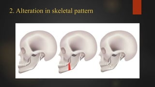 Introduction to orthodontics | PPTX
